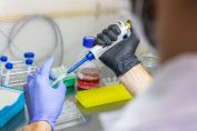 Senasa aprobó una innovadora vacuna contra la rabia animal